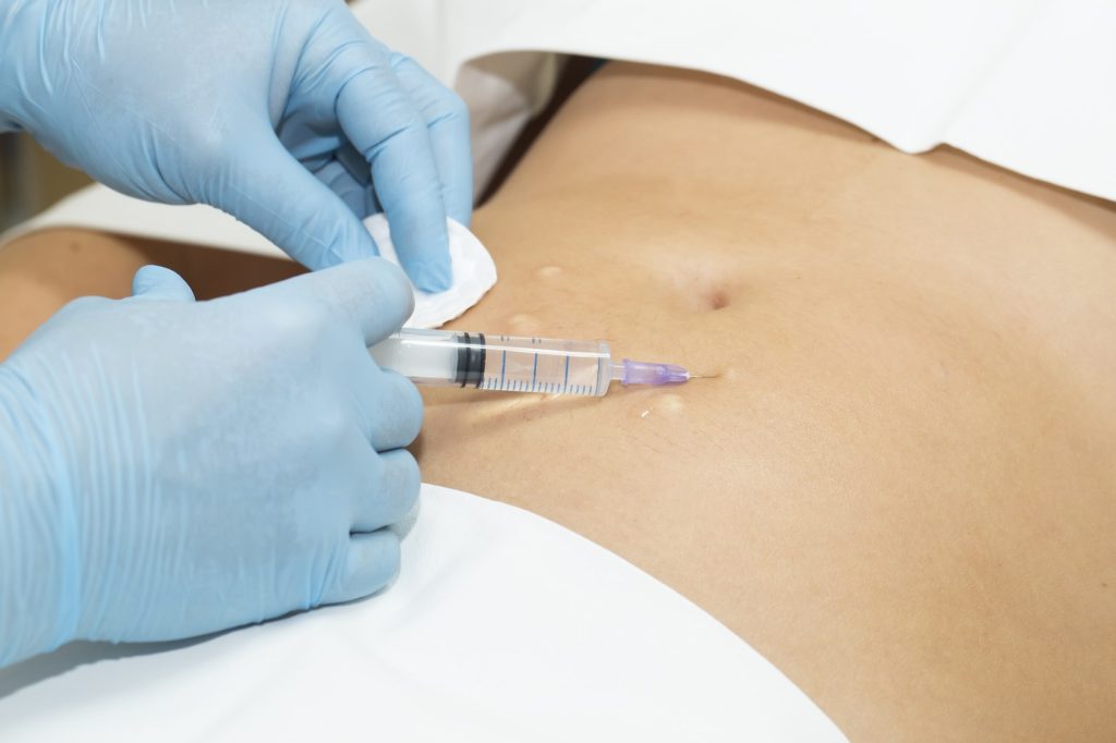 mesotherapy-needle-injection